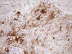 Carboxypeptidase M Antibody in Immunohistochemistry (Paraffin) (IHC (P))