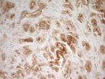 PAK4 Antibody in Immunohistochemistry (Paraffin) (IHC (P))