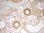 PAK4 Antibody in Immunohistochemistry (Paraffin) (IHC (P))