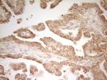 PAK4 Antibody in Immunohistochemistry (Paraffin) (IHC (P))