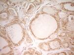 PAK4 Antibody in Immunohistochemistry (Paraffin) (IHC (P))