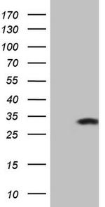 KChIP2 Antibody in Western Blot (WB)