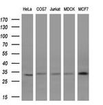 KChIP2 Antibody in Western Blot (WB)