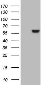 ANGPTL3 Antibody in Western Blot (WB)