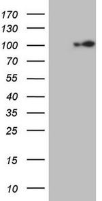 ECT2 Antibody in Western Blot (WB)