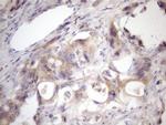 SSX2IP Antibody in Immunohistochemistry (Paraffin) (IHC (P))