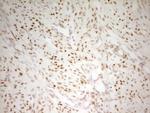 MEF2D Antibody in Immunohistochemistry (Paraffin) (IHC (P))