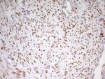 MEF2D Antibody in Immunohistochemistry (Paraffin) (IHC (P))