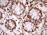 RPL10 Antibody in Immunohistochemistry (Paraffin) (IHC (P))