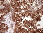 RPL10 Antibody in Immunohistochemistry (Paraffin) (IHC (P))