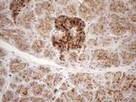 KCTD9 Antibody in Immunohistochemistry (Paraffin) (IHC (P))