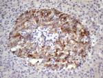 ALOX12 Antibody in Immunohistochemistry (Paraffin) (IHC (P))