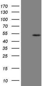 B4GALT4 Antibody in Western Blot (WB)