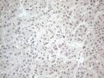 CtBP2 Antibody in Immunohistochemistry (Paraffin) (IHC (P))