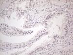 CtBP2 Antibody in Immunohistochemistry (Paraffin) (IHC (P))