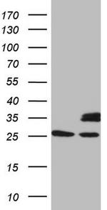 SDHB Antibody in Western Blot (WB)