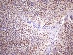 SPT3 Antibody in Immunohistochemistry (Paraffin) (IHC (P))