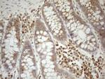 ZNF69 Antibody in Immunohistochemistry (Paraffin) (IHC (P))