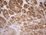 ZNF69 Antibody in Immunohistochemistry (Paraffin) (IHC (P))