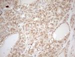 ZNF69 Antibody in Immunohistochemistry (Paraffin) (IHC (P))