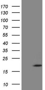 ZNF69 Antibody in Western Blot (WB)