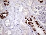 ATP6V1C2 Antibody in Immunohistochemistry (Paraffin) (IHC (P))