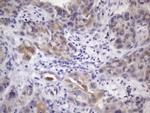 ATP6V1C2 Antibody in Immunohistochemistry (Paraffin) (IHC (P))