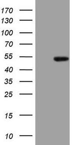 ATP6V1C2 Antibody in Western Blot (WB)