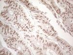 WTAP Antibody in Immunohistochemistry (Paraffin) (IHC (P))