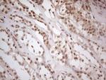 WTAP Antibody in Immunohistochemistry (Paraffin) (IHC (P))