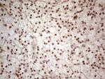 WTAP Antibody in Immunohistochemistry (Paraffin) (IHC (P))