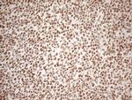 WTAP Antibody in Immunohistochemistry (Paraffin) (IHC (P))