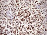 WTAP Antibody in Immunohistochemistry (Paraffin) (IHC (P))