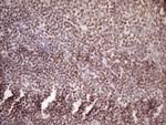 WTAP Antibody in Immunohistochemistry (Paraffin) (IHC (P))