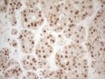 RGL2 Antibody in Immunohistochemistry (Paraffin) (IHC (P))