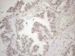 SPT3 Antibody in Immunohistochemistry (Paraffin) (IHC (P))