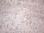 SPT3 Antibody in Immunohistochemistry (Paraffin) (IHC (P))