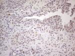 SPT3 Antibody in Immunohistochemistry (Paraffin) (IHC (P))