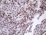 SRSF9 Antibody in Immunohistochemistry (Paraffin) (IHC (P))