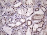 SRSF9 Antibody in Immunohistochemistry (Paraffin) (IHC (P))