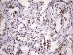 SRSF9 Antibody in Immunohistochemistry (Paraffin) (IHC (P))