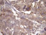 TRBP Antibody in Immunohistochemistry (Paraffin) (IHC (P))