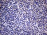 AKIP1 Antibody in Immunohistochemistry (Paraffin) (IHC (P))