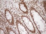 EXOSC1 Antibody in Immunohistochemistry (Paraffin) (IHC (P))