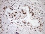 EXOSC1 Antibody in Immunohistochemistry (Paraffin) (IHC (P))