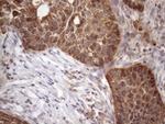 AMTN Antibody in Immunohistochemistry (Paraffin) (IHC (P))