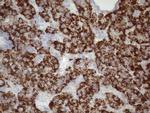 GLYAT Antibody in Immunohistochemistry (Paraffin) (IHC (P))