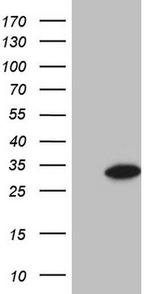 GLYAT Antibody in Western Blot (WB)