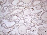 RBMS1 Antibody in Immunohistochemistry (Paraffin) (IHC (P))