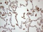 RBMS1 Antibody in Immunohistochemistry (Paraffin) (IHC (P))